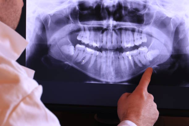 Best Emergency Wisdom Tooth Extraction in Ellport, PA